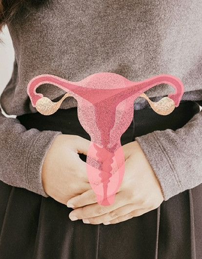 Поликистоз яичников: 5 главных мифов и вся правда