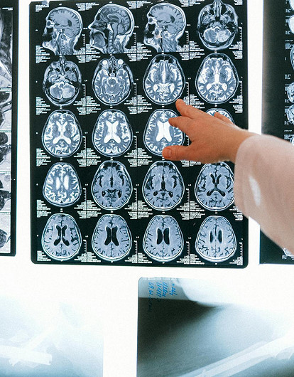 Невролог назвала продукты, улучшающие работу мозга