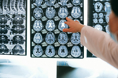 Невролог назвала продукты, улучшающие работу мозга