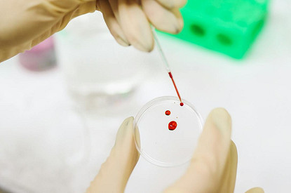 Ученые назвали «самую сильную» группу крови