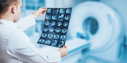 КТ и МРТ: 8 фактов о лучевой диагностике, которые важно знать