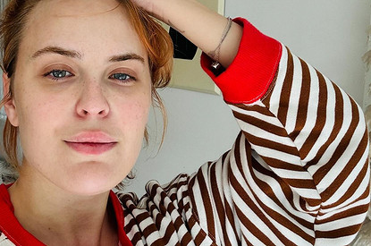 Дочь Брюса Уиллиса и Деми Мур показала лицо после удаления филлеров