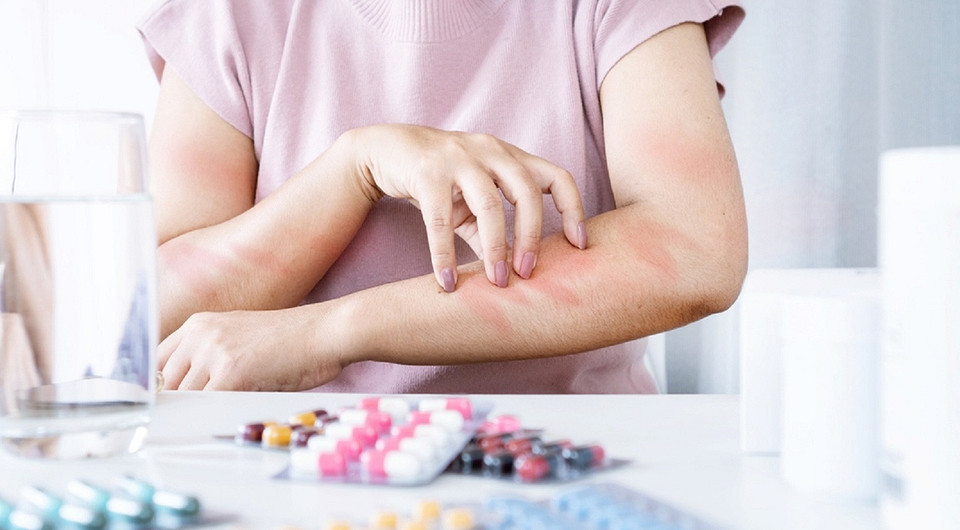 Аллергия на лекарства: как ее распознать и снизить риски появления