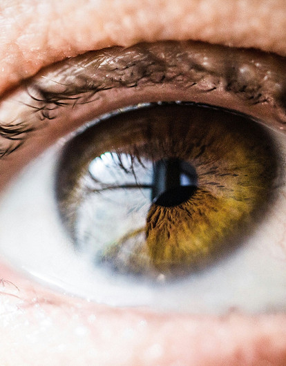 Глазные капли против аллергии: как выбрать правильные