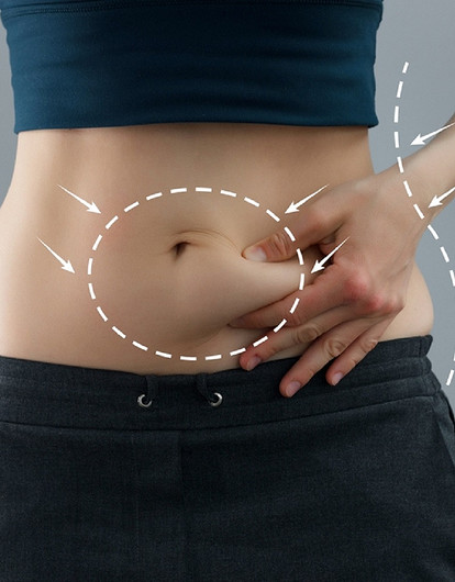 Абдоминопластика: 9 главных фактов, которые важно знать перед операцией