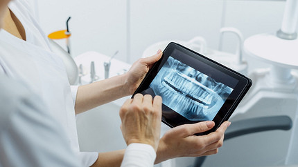 Имплантация зубов: что важно сделать до, во время и после процедуры