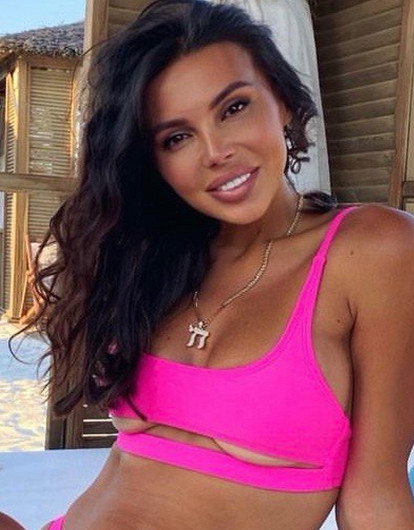 Оксана Самойлова до и после пластики: какие операции делала жена Джигана