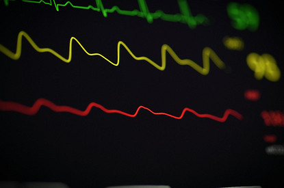 Кардиолог раскрыл опасные симптомы во время жары, которые нельзя игнорировать