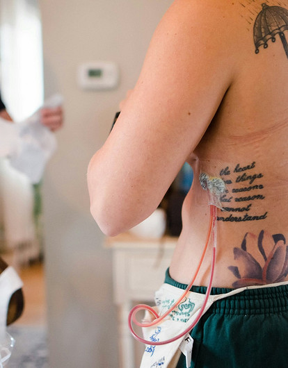 Гинеколог назвала необычный и редкий симптом рака груди