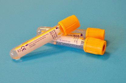 Гликированный гемоглобин: что это за показатель и какое заболевание можно предотвратить, сдав анализ