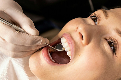 5 интересных фактов про кариес, о которых ты не знала