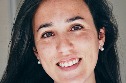 Косметолог объяснила причины появления морщин в молодом возрасте