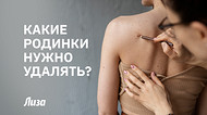 Знаки на коже: какие родинки могут быть опасны для здоровья Знаки на коже: какие родинки могут быть опасны для здоровья