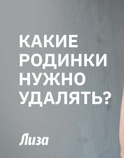 Знаки на коже: какие родинки могут быть опасны для здоровья