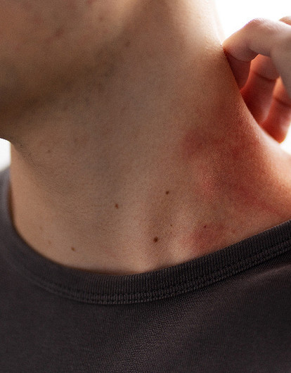 Родинки в виде треугольника на теле: о чем говорит такое «клеймо судьбы»