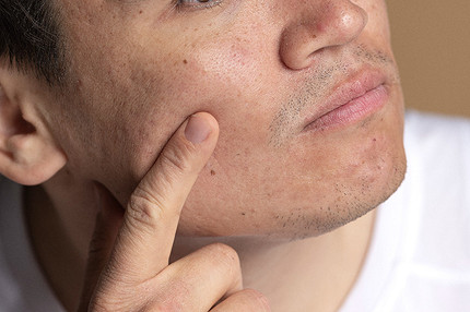 Что значат родинки на лице: трактовка приметы