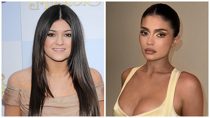 Секреты молодости голливудских звезд: пластические операции и бьюти-лайфхаки