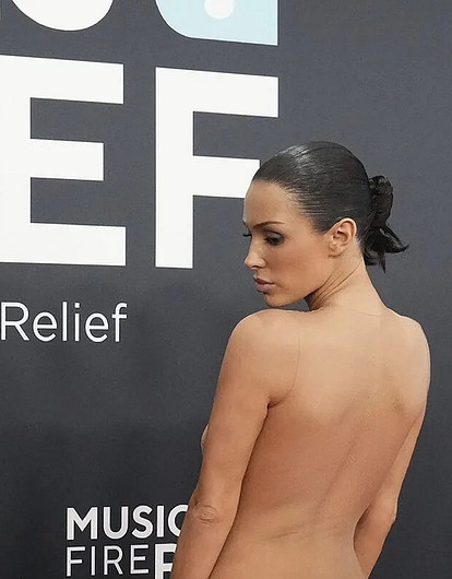 Голое платье жены Канье Уэста спровоцировало спрос на пластические операции