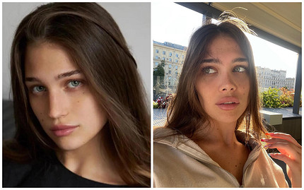 Мария Мотина до пластики носа