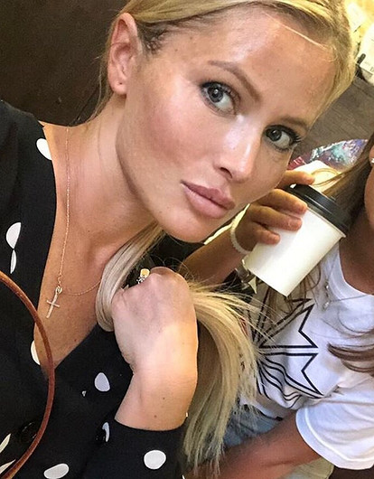 Она думала с 13 лет: Дана Борисова рассказала, почему согласилась оплатить 17-летней дочери ринопластику