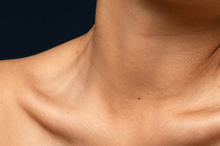 Что значит родинка на шее: расшифровка приметы по количеству и расположению на коже