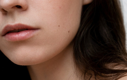 Значение родинок на щеке: трактовка отметин на правой и левой стороне