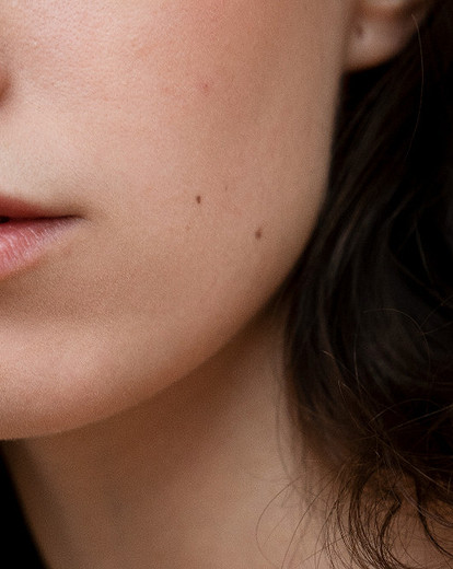 Значение родинок на щеке: трактовка отметин на правой и левой стороне