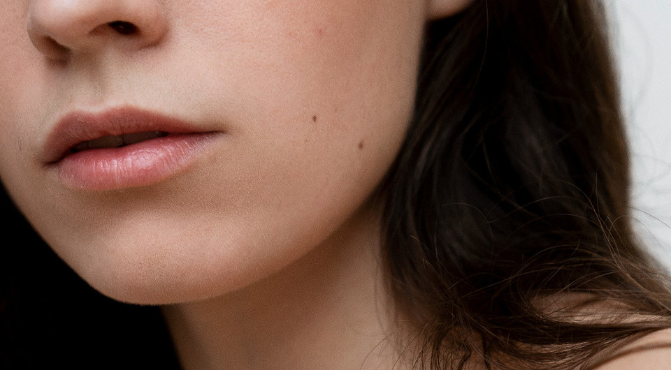 Значение родинок на щеке: трактовка отметин на правой и левой стороне