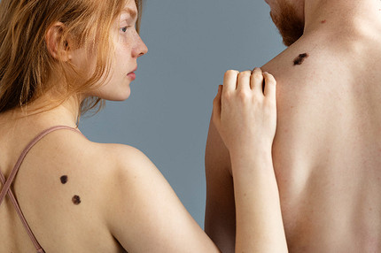 Что значат родимые пятна на теле: трактовки с точки зрения эзотерики