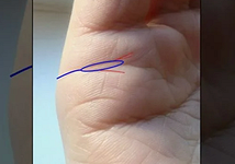 Островок на линии брака — символ кризиса и испытаний.