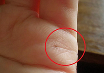 Родинка на линии может говорить о том, что влияние партнера очень отразится на человеке.