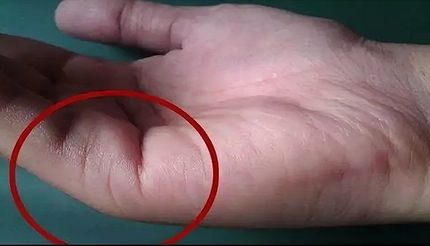 Линия брака на руке: где находится на ладони и что предсказывает