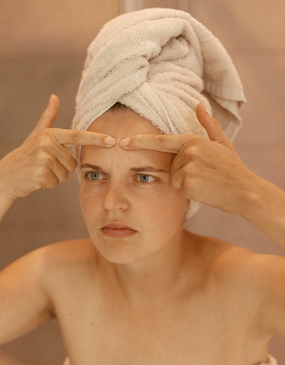 Что значит прыщ на лбу с точки зрения примет