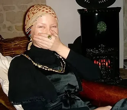 Кайли Миноуг во время второй химиотерапии
