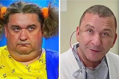 Это последняя операция: юморист Александр Морозов показал себя после пластики лица