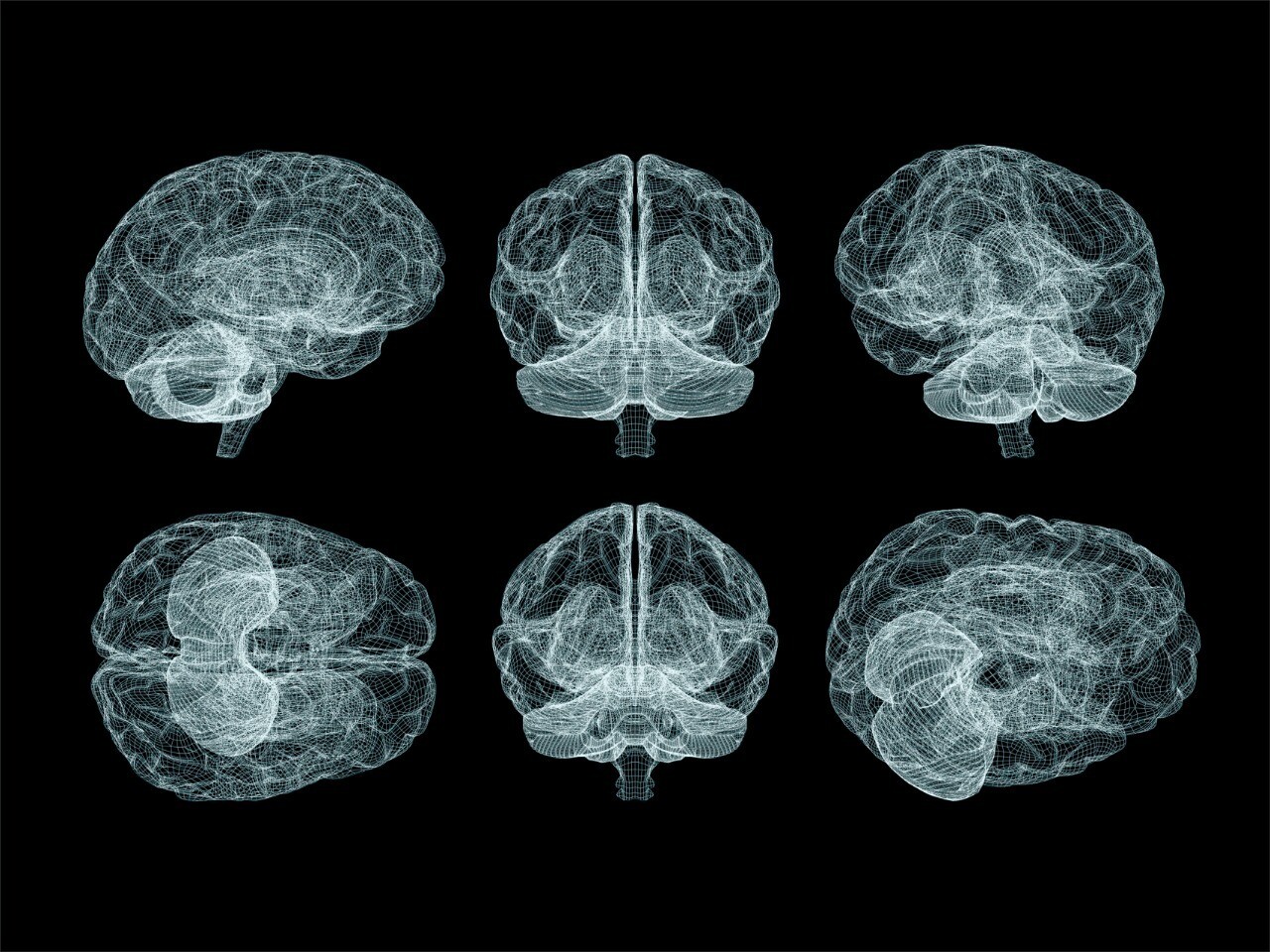 Что такое глиоз головного мозга и сколько живут с этой болезнью