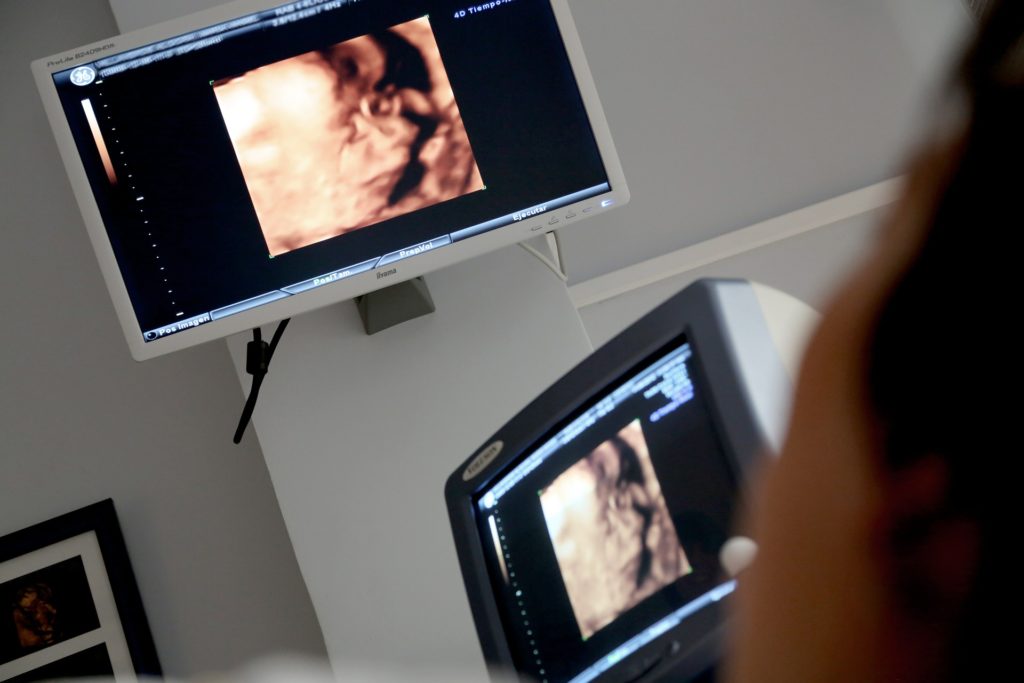 Во время беременности на ранних сроках: 10 запретов для будущих мам